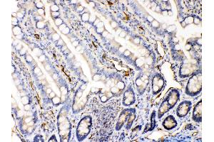 IHC analysis of Bax using anti-Bax antibody . (BAX Antikörper  (N-Term))