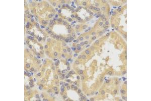 Immunohistochemistry of paraffin-embedded human kidney using SMYD5 antibody (ABIN6129324, ABIN6148173, ABIN6148174 and ABIN6221783). (SMYD5 Antikörper)