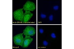 ABIN2630016 Immunofluorescence analysis of paraformaldehyde fixed U2OS cells, permeabilized with 0. (CTNNB1 Antikörper  (AA 108-121))