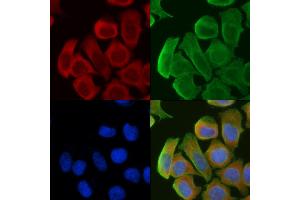ABIN6261640 and ABIN6276821 staining Hela cells(30 min of UV treatment) by IF/ICC. (F12 Antikörper  (C-Term))