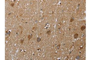 The image on the left is immunohistochemistry of paraffin-embedded Human brain tissue using ABIN7129016(COX6B2 Antibody) at dilution 1/50, on the right is treated with fusion protein. (COX6B2 Antikörper)