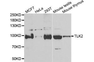 Western blot analysis of extracts of various cell lines, using TLK2 antibody. (TLK2 Antikörper)