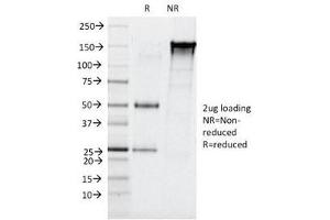 SDS-PAGE Analysis of Purified, BSA-Free Elastase 3B Antibody (clone CELA3B/1257). (Elastase 3B Antikörper  (AA 82-238))