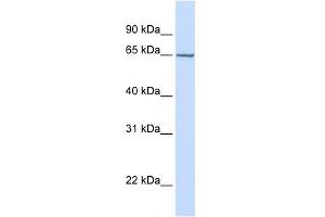 GALNAC4S-6ST antibody used at 1 ug/ml to detect target protein. (CHST15 Antikörper  (Middle Region))