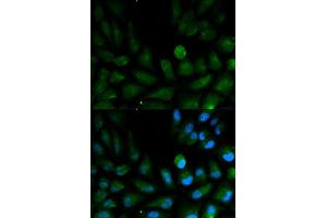Immunofluorescence analysis of HepG2 cell using CAPZA2 antibody. (CAPZA2 Antikörper  (AA 1-286))