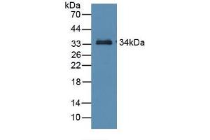 Western blot analysis of recombinant Mouse RBP3. (RBP3 Antikörper  (AA 18-320))