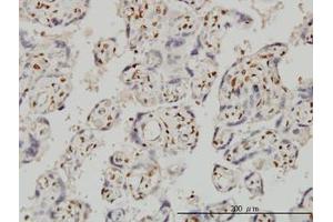 Image no. 1 for anti-Forkhead Box R2 (FOXR2) (AA 1-312) antibody (ABIN599326) (FOXR2 Antikörper  (AA 1-312))