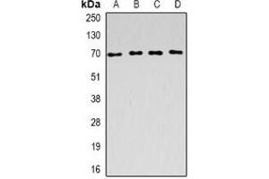 Western blot analysis of ACADVL expression in SW620 (A), Raji (B), mouse kidney (C), rat liver (D) whole cell lysates. (ACADVL Antikörper)