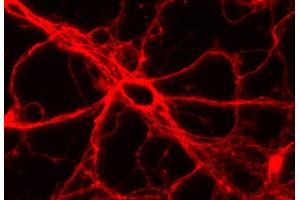 Immunocytochemistry (ICC) image for anti-tau Protein (AA 3-214) antibody (ABIN1742569) (tau Antikörper  (AA 3-214))