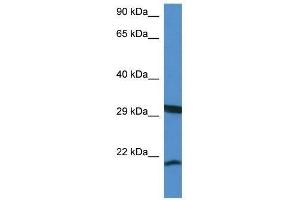 Western Blot showing Rhebl1 antibody used at a concentration of 1. (RHEBL1 Antikörper  (N-Term))