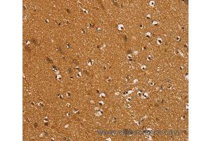 Immunohistochemistry of Human brain  using SLC16A3 Polyclonal Antibody at dilution of 1:30 (SLC16A3 Antikörper)