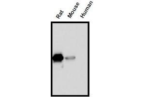 Western Blotting (WB) image for anti-Interleukin 18 (IL18) (AA 37-194) antibody (ABIN1449292) (IL-18 Antikörper  (AA 37-194))