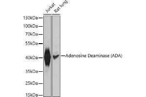 Western Blotting (WB) image for anti-Adenosine Deaminase (ADA) (AA 1-363) antibody (ABIN3021282)