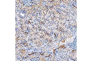 IHC analysis of SNRNP200 using anti-SNRNP200 antibody (ABIN7602032). (SNRNP200 Antikörper  (AA 557-2129))