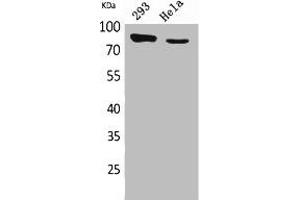 Western Blot analysis of 293, HeLa cells using DRA Polyclonal Antibody. (SLC26A3 Antikörper  (C-Term))