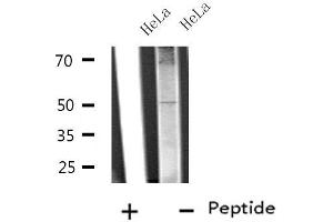 Western blot analysis of extracts from HeLa cells, using SLC38A2 antibody. (SLC38A2 Antikörper  (Internal Region))