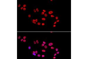 Immunofluorescence (IF) image for anti-X-Ray Repair Complementing Defective Repair in Chinese Hamster Cells 5 (Double-Strand-Break Rejoining) (XRCC5) (AA 543-732) antibody (ABIN6150309)