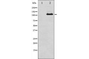 Western blot analysis of Progesterone Receptor expression in whole cell lysates,The lane on the left is treated with the antigen-specific peptide. (Progesterone Receptor Antikörper)