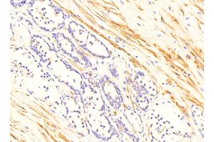 Immunohistochemistry (IHC) image for anti-Transglutaminase 4 (Prostate) (TGM4) (N-Term) antibody (ABIN2777148)