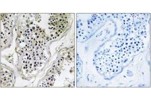 Immunohistochemistry analysis of paraffin-embedded human testis tissue, using ATXN7L1 Antibody. (ATXN7L1 Antikörper  (AA 441-490))