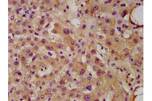 IHC image of ABIN7174623 diluted at 1:300 and staining in paraffin-embedded human liver tissue performed on a Leica BondTM system. (UGT1A1 Antikörper  (AA 395-482))