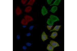 ABIN7096890 and ABIN7100956 staining Hela cells(30 min of UV treatment) by IF/ICC. (QPCTL Antikörper)