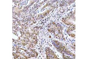 IHC analysis of ARID1A using anti-ARID1A antibody (ABIN7602567).