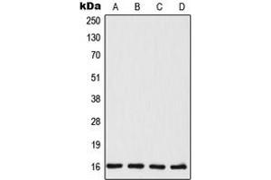 Western blot analysis of TSC22 expression in MCF7 (A), HeLa (B), mouse liver (C), rat liver (D) whole cell lysates.