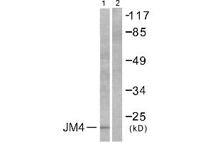 Western blot analysis of extracts from LOVO cells, using JM4 antibody (#C0238). (PRAF2 Antikörper)