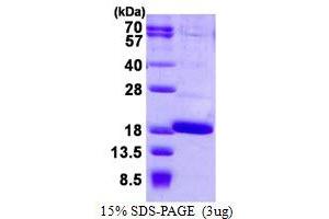 Fatty Acid Binding Protein 12 (FABP12) (AA 1-140) protein (His tag)