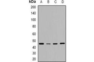 Western blot analysis of CD240d expression in HeLa (A), NIH3T3 (B), mouse brain (C), rat brain (D) whole cell lysates. (RHD Antikörper)