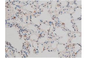 ABIN6267411 at 1/200 staining Rat lung tissue sections by IHC-P. (JunD Antikörper  (pSer255))