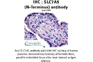 Image no. 1 for anti-Solute Carrier Family 7 (Cationic Amino Acid Transporter, Y+ System), Member 5 (SLC7A5) (N-Term) antibody (ABIN1739423)