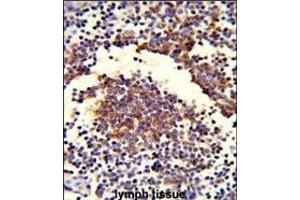 Formalin-fixed and paraffin-embedded human lymph tissue reacted with C7 Antibody (Center), which was peroxidase-conjugated to the secondary antibody, followed by DAB staining. (C7 Antikörper  (Center))