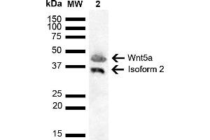 Western blot analysis of Human Cervical cancer cell line (HeLa) lysate showing detection of ~42. (WNT5A Antikörper  (AA 200-300))