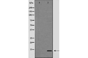 Western blot analysis of Trefoil factor 2（TFF2） expression in HeLa cells,The lane on the left is treated with the antigen-specific peptide. (Trefoil Factor 2 Antikörper  (Internal Region))