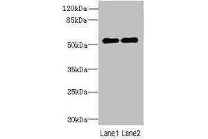 Western blot All lanes: TRMT6 antibody at 4 μg/mL Lane 1: U251 whole cell lysate Lane 2: HepG2 whole cell lysate Secondary Goat polyclonal to rabbit IgG at 1/10000 dilution Predicted band size: 56, 45, 41, 37 kDa Observed band size: 56 kDa (TRMT6 Antikörper  (Catalytic Subunit))