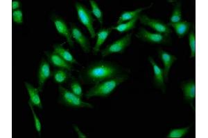 Immunofluorescence staining of Hela cells with ABIN7143628 at 1:33, counter-stained with DAPI. (AARS Antikörper  (AA 164-321))