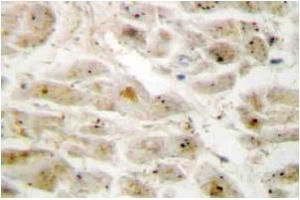 Immunohistochemistry: LIMK2 antibody staining of Paraffin-Embedded Human brain tissue. (LIMK2 Antikörper)