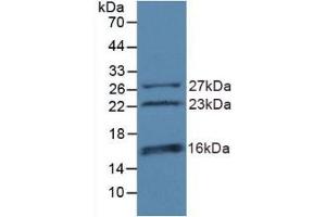 Detection of Recombinant CHD3, Human using Polyclonal Antibody to Chromodomain Helicase DNA Binding Protein 3 (CHD3) (CHD3 Antikörper  (AA 1551-1742))