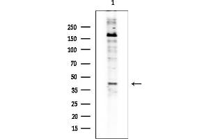 anti-ST3 beta-Galactoside alpha-2,3-Sialyltransferase 3 (ST3GAL3) (C-Term) antibody