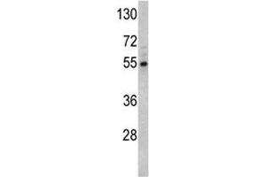 Western blot analysis of Fascin antibody and Y79 lysate. (Fascin Antikörper  (AA 322-350))
