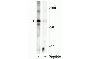 Western blot of mouse whole brain lysate showing specific immunolabeling of the ~55 kDa truncated MeCP2 protein phosphorylated at Ser421 in the first lane (-).
