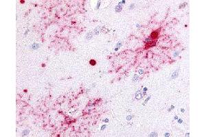 Immunohistochemical (Formalin/PFA-fixed paraffin-embedded sections) staining in human brain with GPR37 polyclonal antibody . (GPR37 Antikörper)