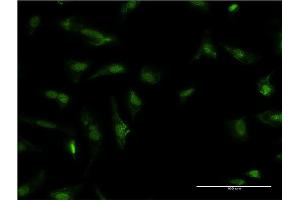 Immunofluorescence of monoclonal antibody to HDGF on HeLa cell. (HDGF Antikörper  (AA 184-240))