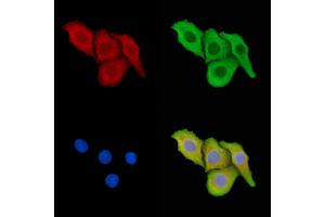 ABIN7095319 and ABIN7099376 staining Hela cells by IF/ICC. (P4HA3 Antikörper)