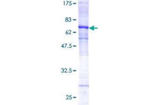 Cathepsin L Protein (AA 18-333) (GST tag)