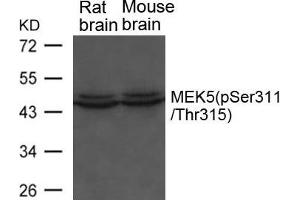 Western blot analysis of extracts from Rat and Mouse brain tissue using MEK5(phospho-Ser311/ Thr315) Antibody. (MAP2K5 Antikörper  (pSer311, pThr315))