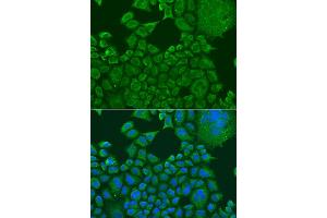 Immunofluorescence analysis of U2OS cells using FXR1 antibody (ABIN1876971) at dilution of 1:100. (FXR1 Antikörper)