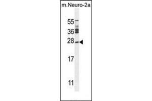 Western blot analysis of Josephin-2 Antibody (N-term) in mouse Neuro-2a cell line lysates (35ug/lane). (JOSD2 Antikörper  (N-Term))